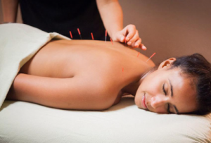 acupuncture post covid 19 treatment recovery chinese